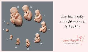 برگزاری کنفرانس علمی &quot;پیشگیری وکاهش سقط خودبخودی &quot;به دبیری علمی دکتر سارا عابدیان دکترای تخصصی مامایی و استادیار دانشگاه مورخ ۱۴۰۴/۰۹/۲۵