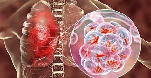 کنفرانس علمی یک روزه کنترل بیماری سل مورخه ۱۴۰۲/۰۳/۲۲ با دبیری علمی استاد گرامی جناب آقای دکتر احسان نزاکتی علیزاده متخصص بیماری های عفونی برگزار شد.