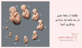 برگزاری کنفرانس علمی "پیشگیری وکاهش سقط خودبخودی "به دبیری علمی دکتر سارا عابدیان دکترای تخصصی مامایی و استادیار دانشگاه مورخ ۱۴۰۴/۰۹/۲۵