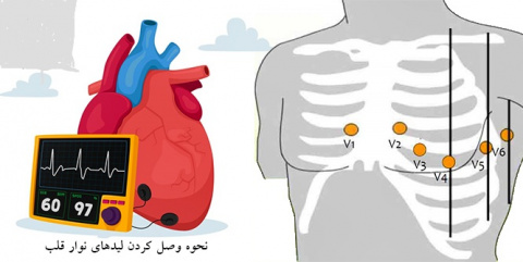 کنفرانس علمی یک روزه مقدمات وتفسیر پیشرفته ECGبه دبیری علمی جناب آقای دکتر حسین ابراهیمی استاد دانشگاه علوم پزشکی شاهرودمورخ ۱۴۰۳/۱۰/۲۳