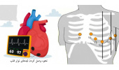Holding a one-day scientific conference on the basics and advanced interpretation of ECG,