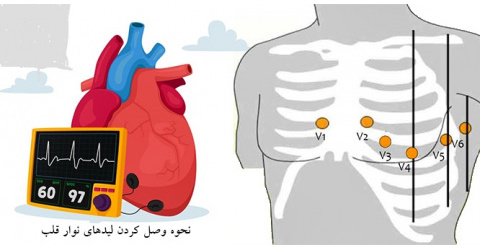Holding a one-day scientific conference on the basics and advanced interpretation of ECG,